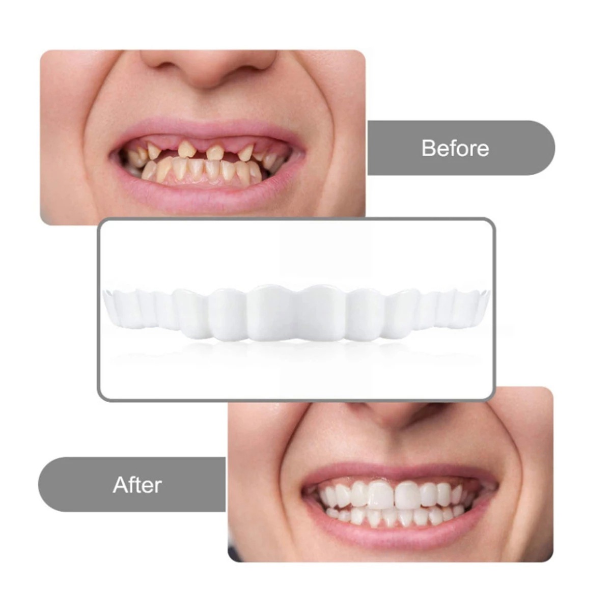 PLACA DENTAL CARILLAs SNAP ON SMILE