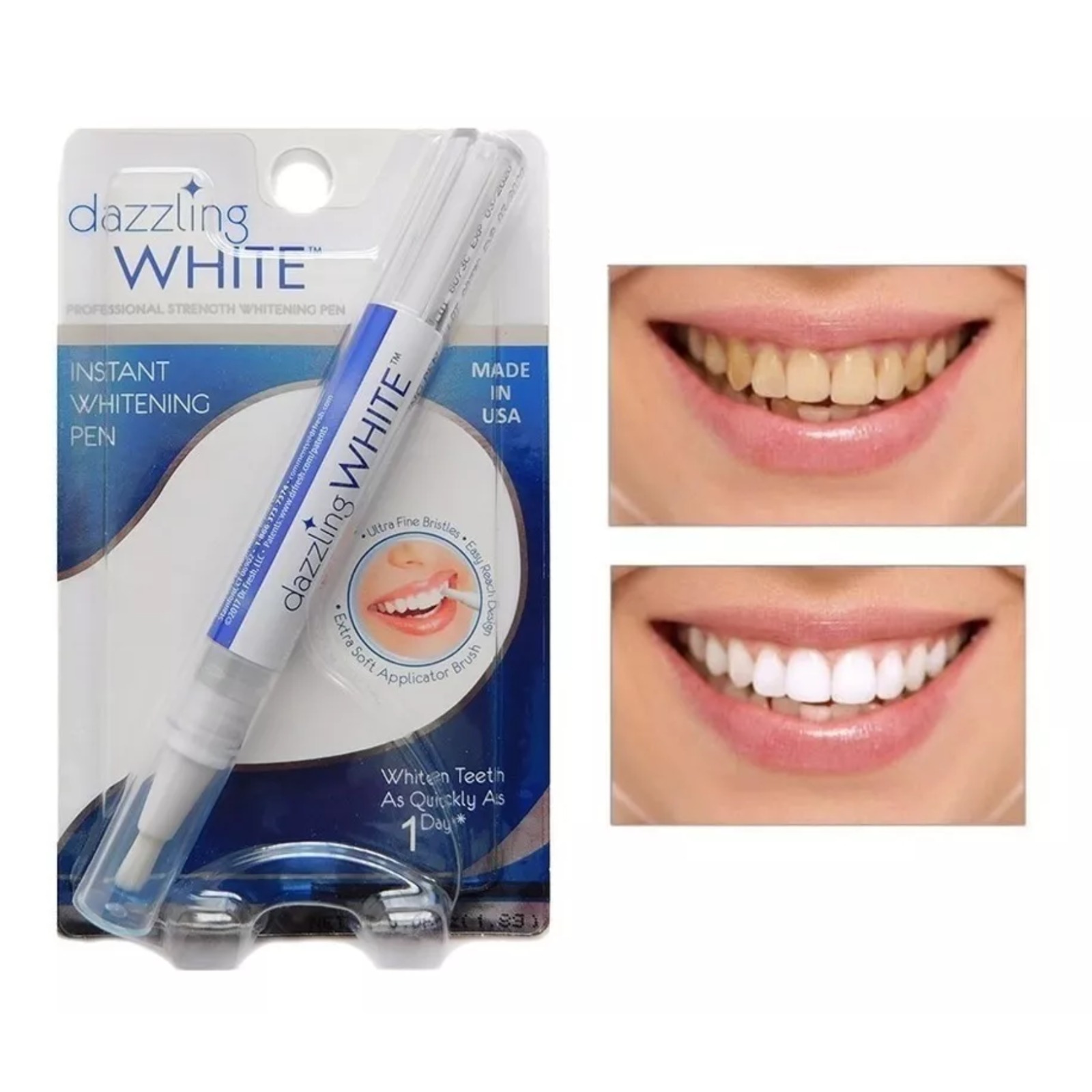 Lápiz blanqueador de dientes