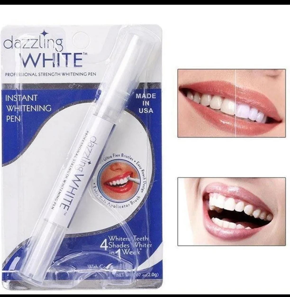 DIENTES WHITE