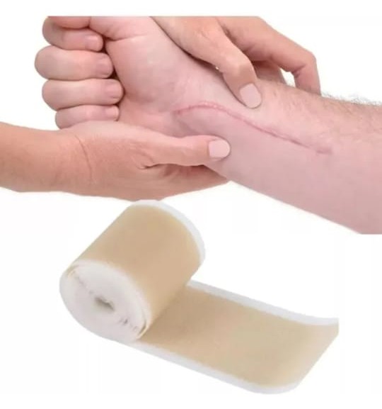 Rollo 4cm x 100cm para cicatrices