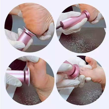 Vista 4 de QUITA CALLO