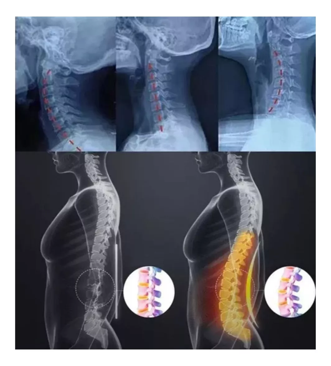 Miniatura 3 de SOPORTE CUELLO ALMOHADA DE ESTIRAMIENTO