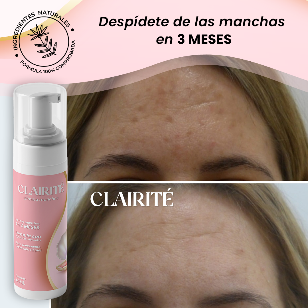 Clarité Despigmentante aclarador