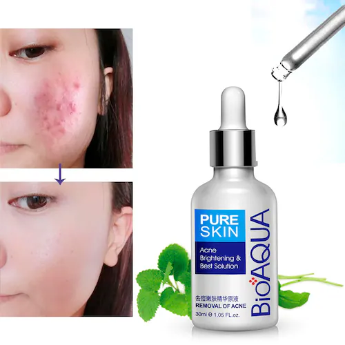 Miniatura 6 de SERUM FACIAL ANTIACNE BIOAQUA