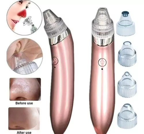 Miniatura 3 de Extractor De Puntos Negros Y Espinillas