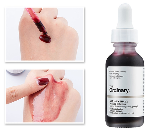 KIT RENOVACION COMPLETA + CAJA