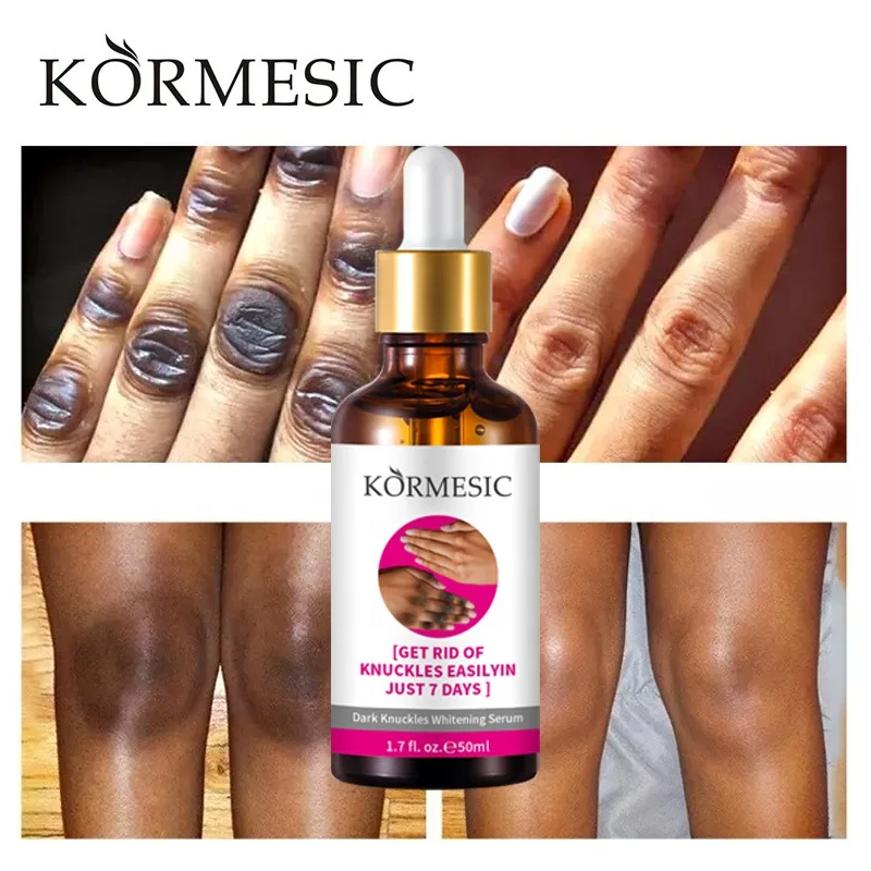 SERUM BLANQUEADOR DE NUDILLOS KORMESIC