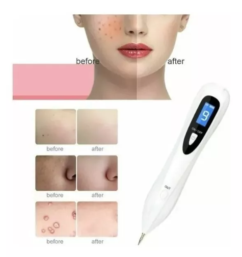 Miniatura 3 de Removedor Cauterizador Quita Verrugas