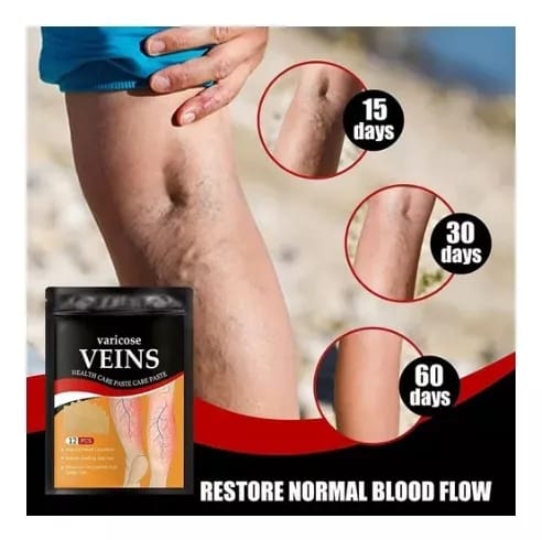 Miniatura 5 de Parche vena varice pague 1 lleve 3