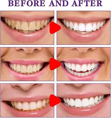 Crema blanqueadora de dientes pasta dent