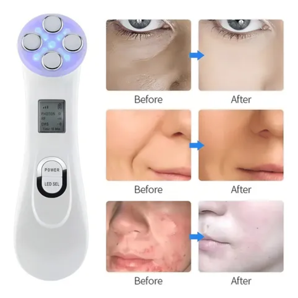 Miniatura 2 de Radiofrecuencia Facial Led