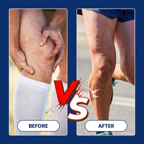 Crema Para El Cuidado De Meniscos