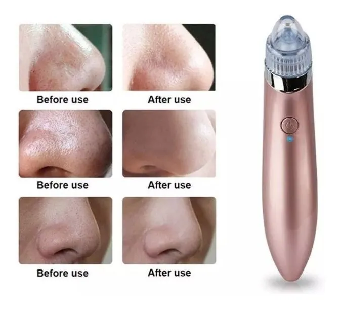 EXTRACTOR ESPINILLAS