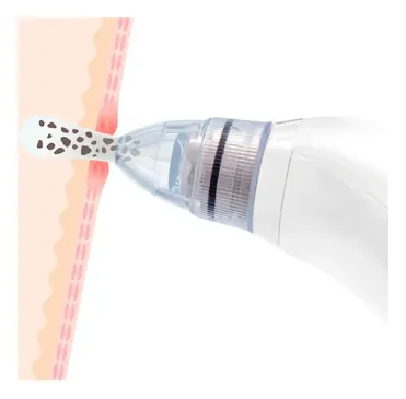 Miniatura 3 de EXTRACTOR ESPINILLAS