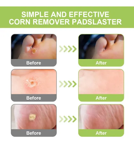 Miniatura 2 de PARCHE DE PIES ELIMINA OJOS DE PEZ