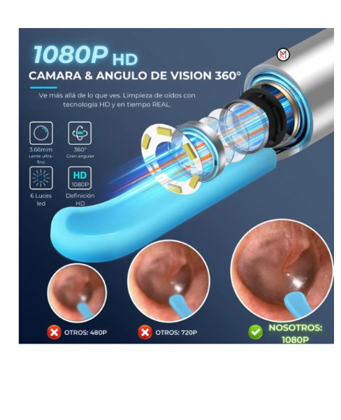 Miniatura 5 de Limpiador De Oídos Inteligente