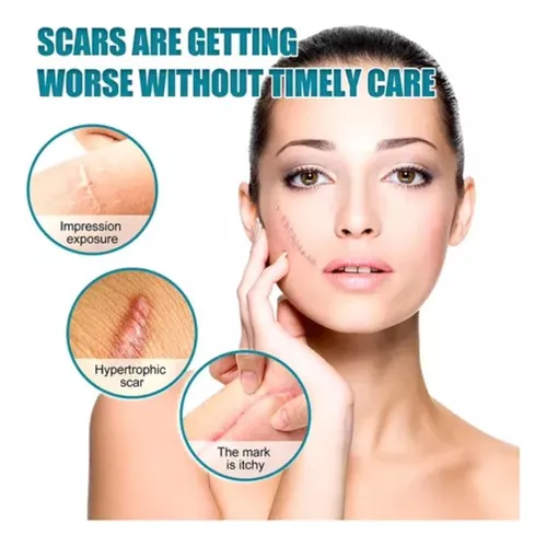 Miniatura 4 de Cinta silicona para cicatrices