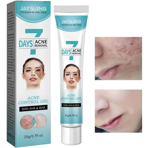 Miniatura 2 de CREMA TRATAMIENTO ACNE 7 DAYS