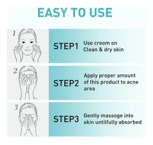 CREMA TRATAMIENTO ACNE 7 DAYS