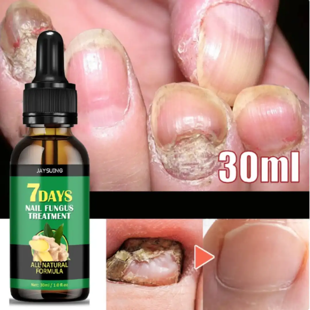 Vista 2 de 7 DIAS ELIMINA HONGO