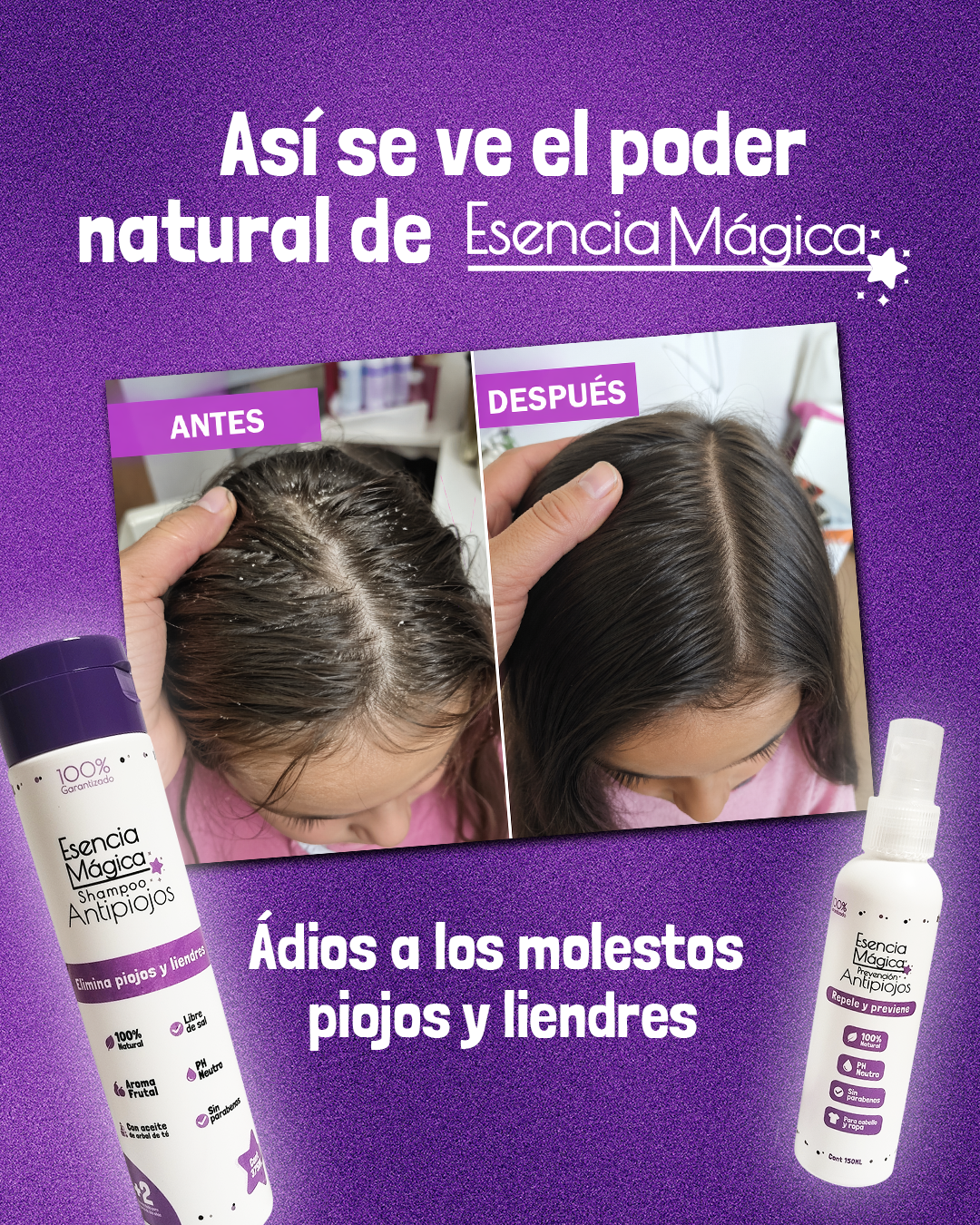 Kit antipiojos + spray repelente