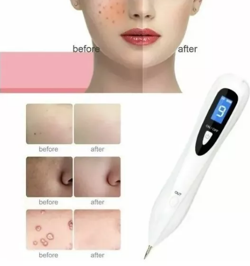 Miniatura 1 de Removedor Cauterizador Quita Verrugas