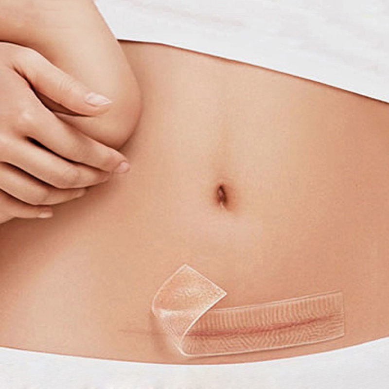 Miniatura 6 de Cinta silicona eliminación de cicatrices