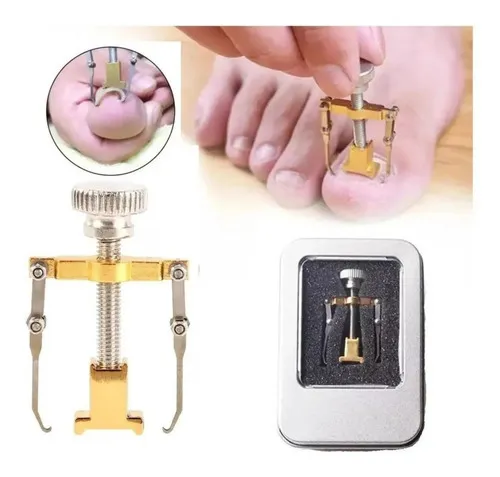 Miniatura 4 de Uñas Encarnadas Corrector solución