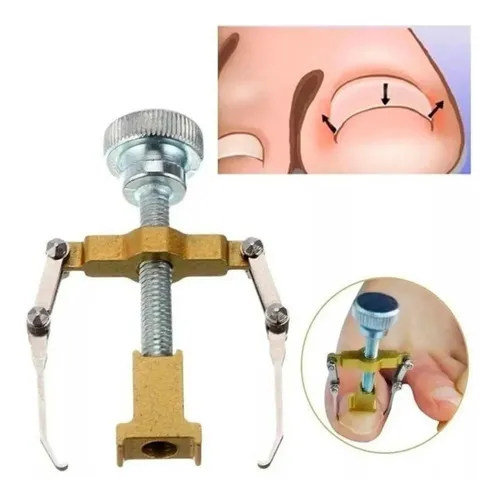 Uñas Encarnadas Corrector solución