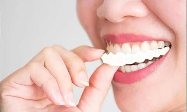 Miniatura 5 de CARILLAS DENTALES SUPERIOR E INFERIOR