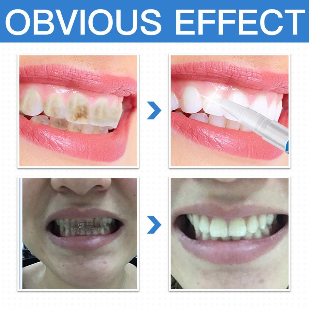 Miniatura 4 de LAPIZ BLANQUEADOR DENTAL