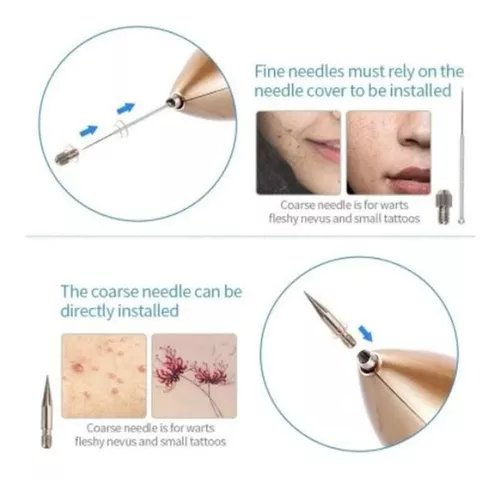 Miniatura 5 de Cauterizador Recargable Quita Verrugas