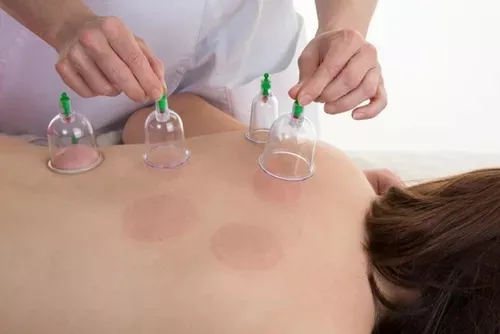 Miniatura 4 de Vacumterapia Manual Terapia Al Vacio X6