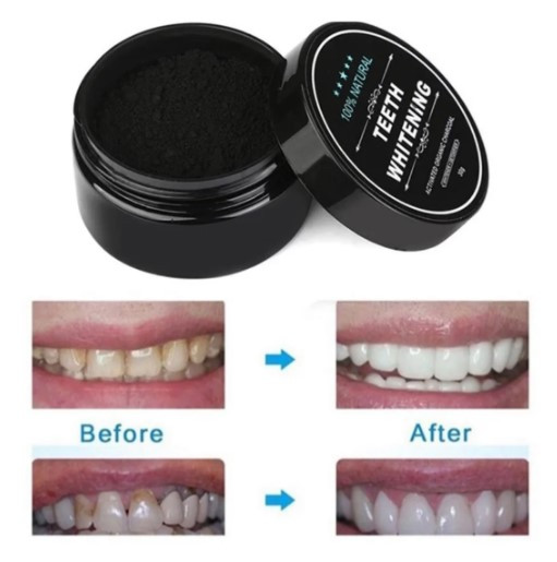 Miniatura 2 de Carbón Activado Teeth Whitening