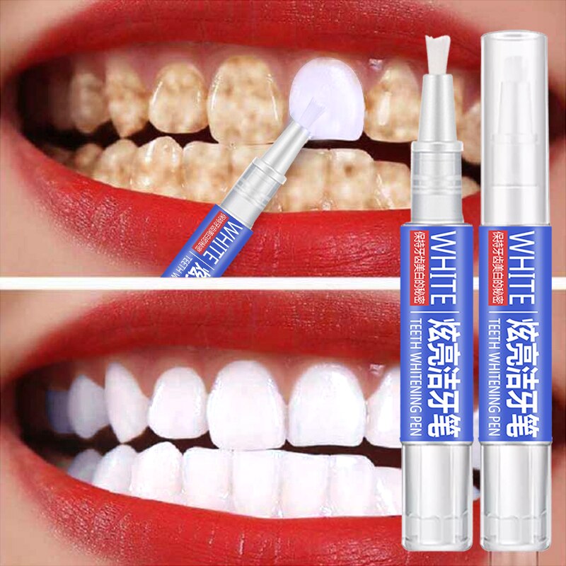 KIT BLANQUEMIENTO DENTAL (CARBON 30GR)