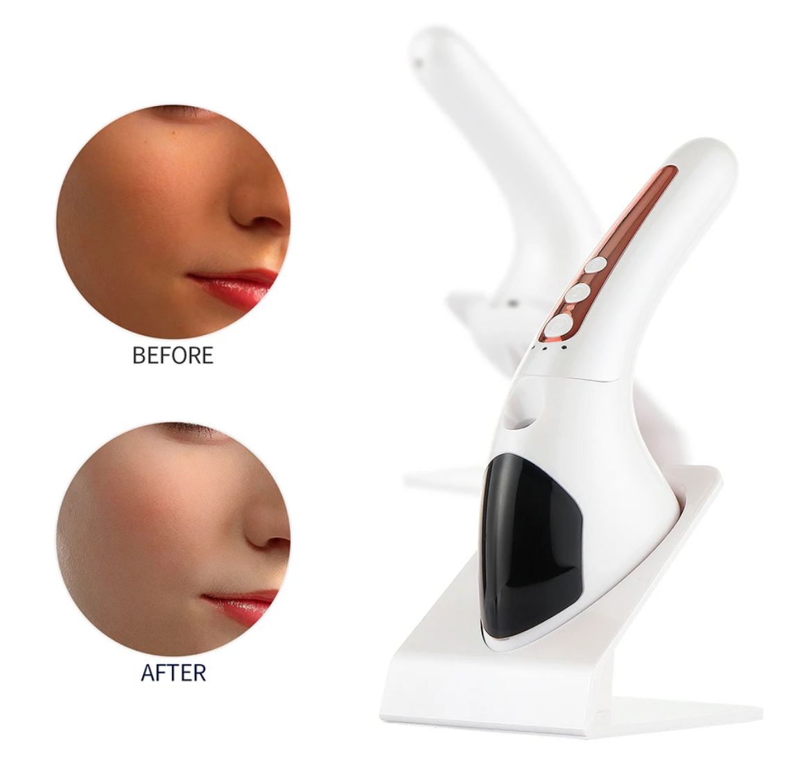 FOTO REJUVENECEDOR XL-2308