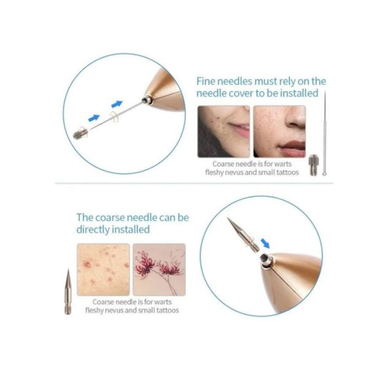 Miniatura 3 de Cauterizador Quita Verrugas Pantalla Led