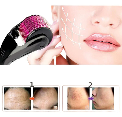 Miniatura 3 de Rodillo Acné Micro agujas Manual ⚡