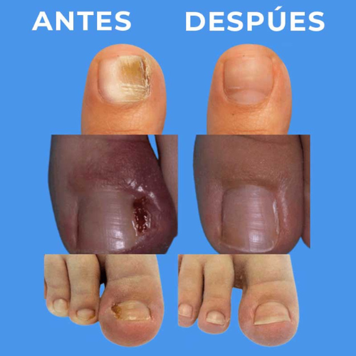 Miniatura 2 de PARCHE PARA UÑAS X 50