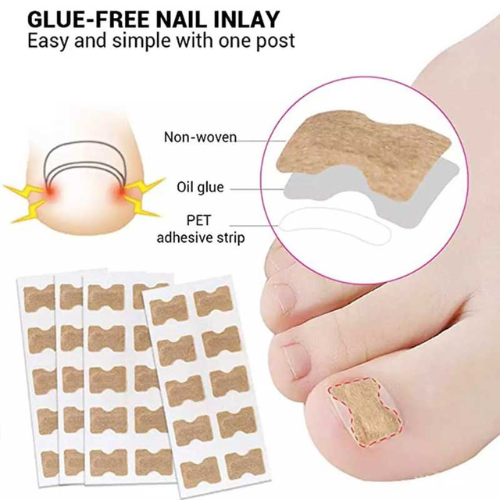 PARCHE PARA UÑAS X 50