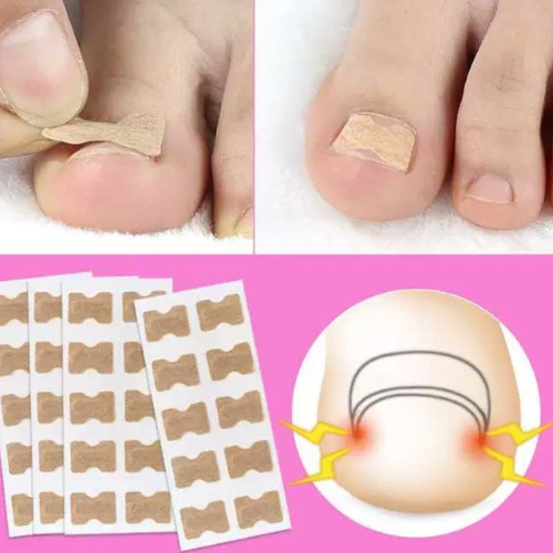 Miniatura 3 de PARCHE PARA UÑAS X 50