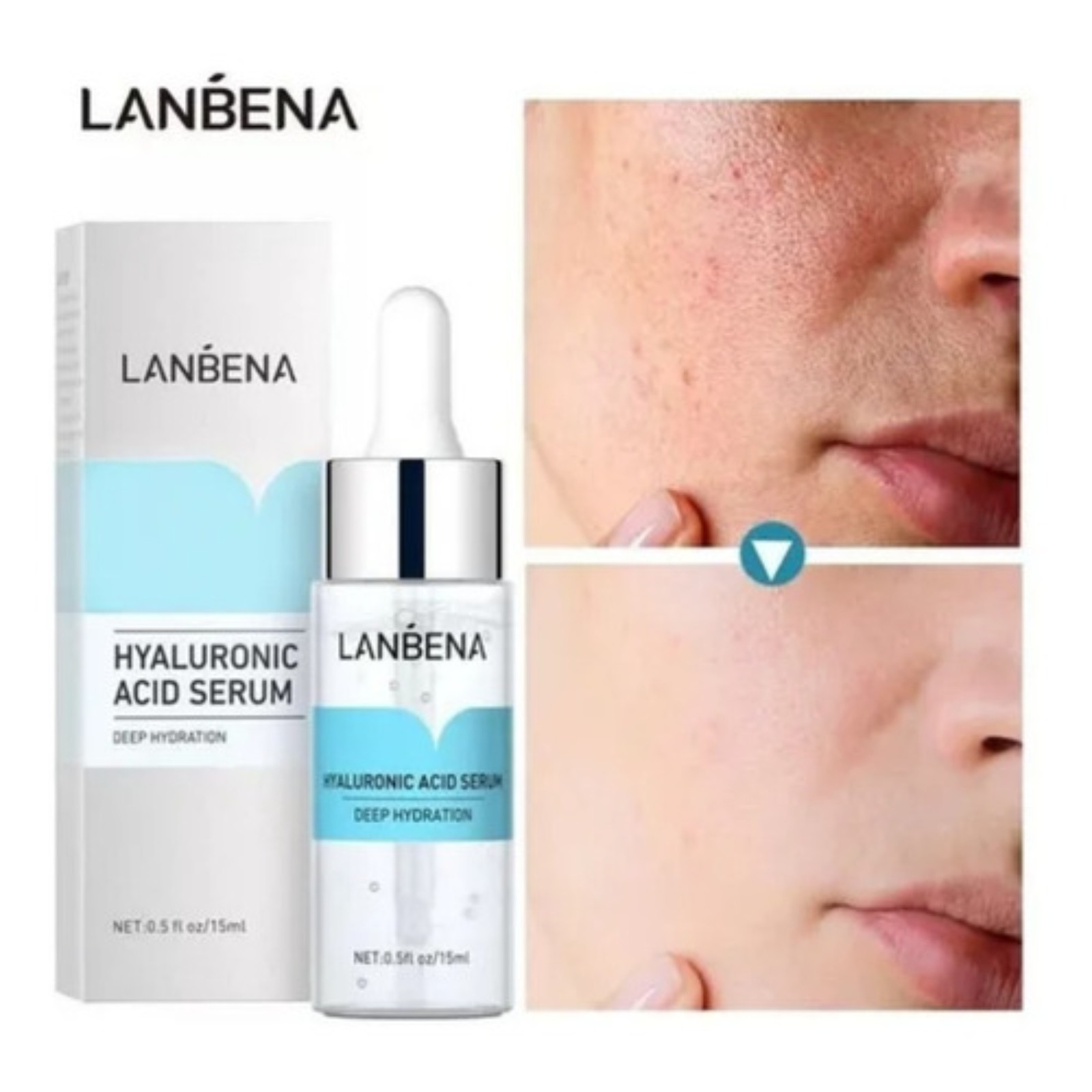 Miniatura 4 de Serum Lanbena Ácido Hialurónico