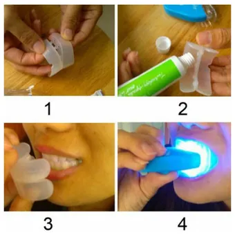 Kit De Blanqueamiento Dental Profesional