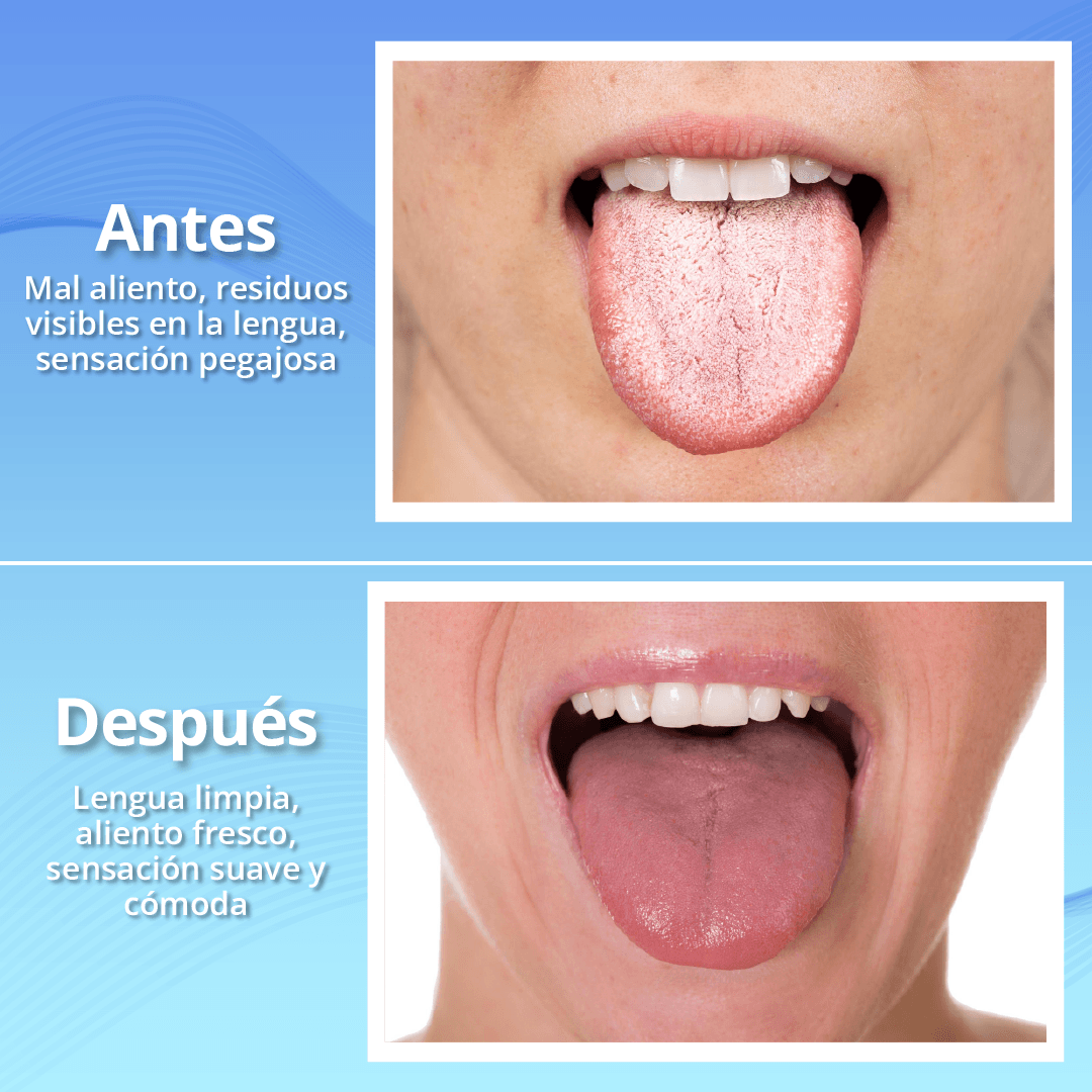 Miniatura 2 de GEL LIMPIADOR DE LENGUA CEPILLO FRESCO