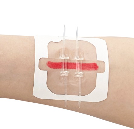 Cura Cierre Herida sin sutura x2