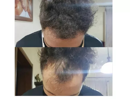 Miniatura 2 de TOPPIK FIBRAS CAPILARES 27.5 G