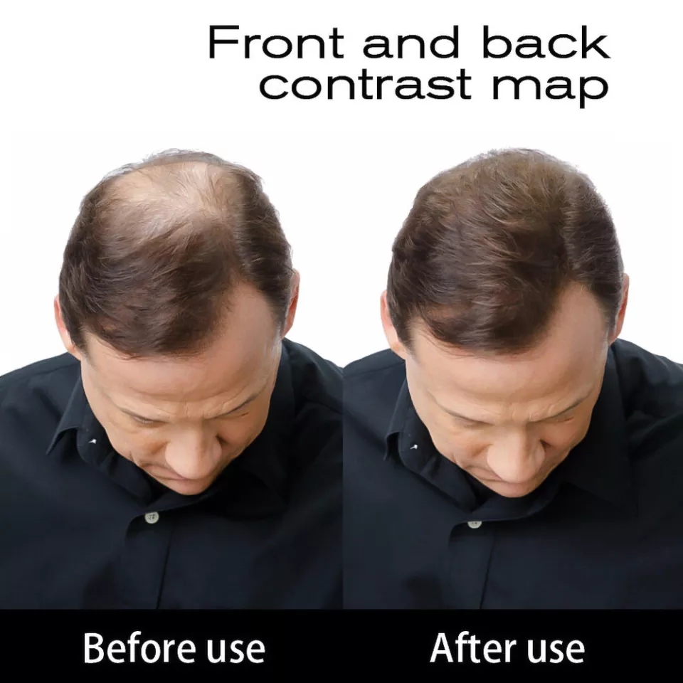 Miniatura 4 de TOPPIK FIBRAS CAPILARES 27.5 G