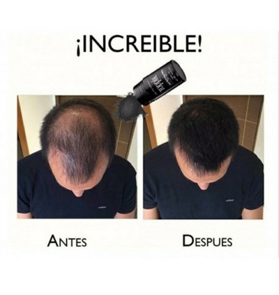 Miniatura 10 de TOPPIK FIBRAS CAPILARES 27.5 G