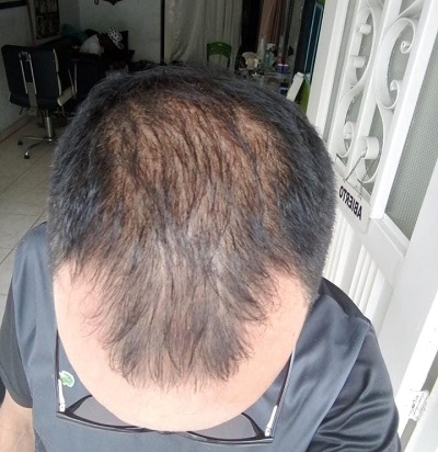 Miniatura 9 de TOPPIK FIBRAS CAPILARES 27.5 G