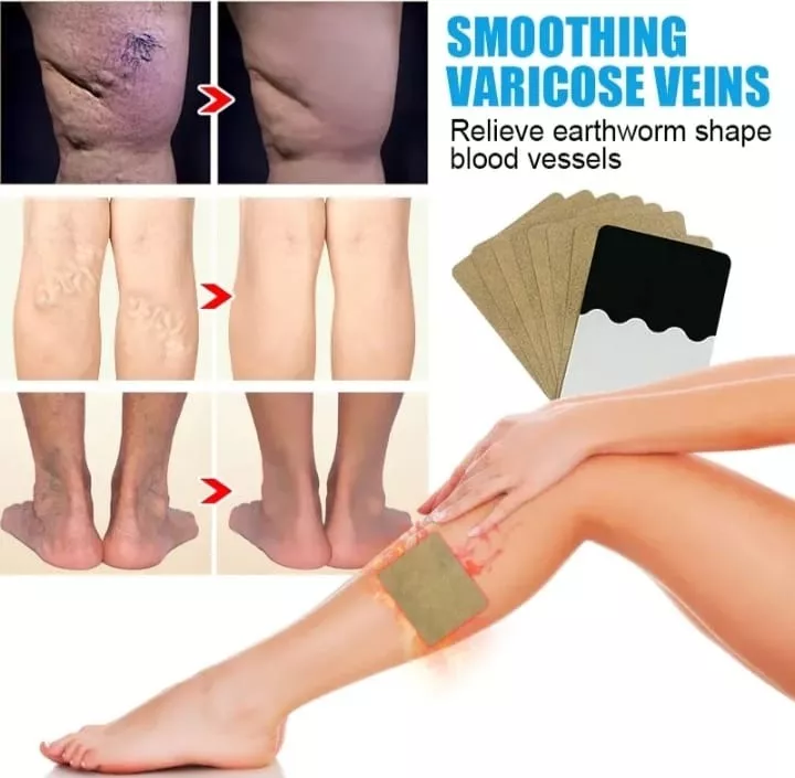 Miniatura 2 de Parches Alivia Varices Vena Varicosa
